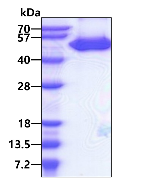 3 μg by SDS-PAGE under reducing condition and visualized by coomassie blue stain